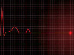 Adult cardiac Arrest (ALS)