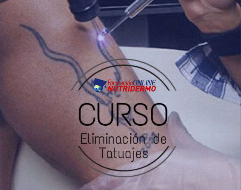 Curso Online  Eliminación Tatoo (Láser Q-switched, ND;YAG)