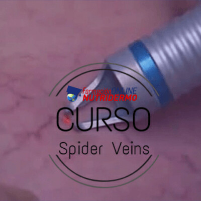 Curso Online de Spider Veins " Eliminación Arañas Vasculares – Telangiectasias"