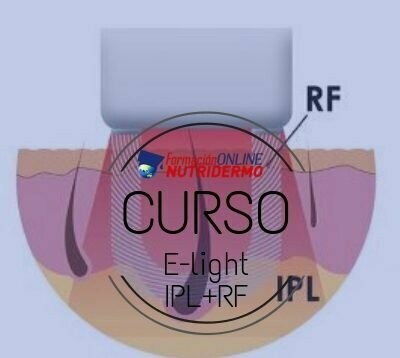 Curso Online de E-light – Elos (IPL+RF)