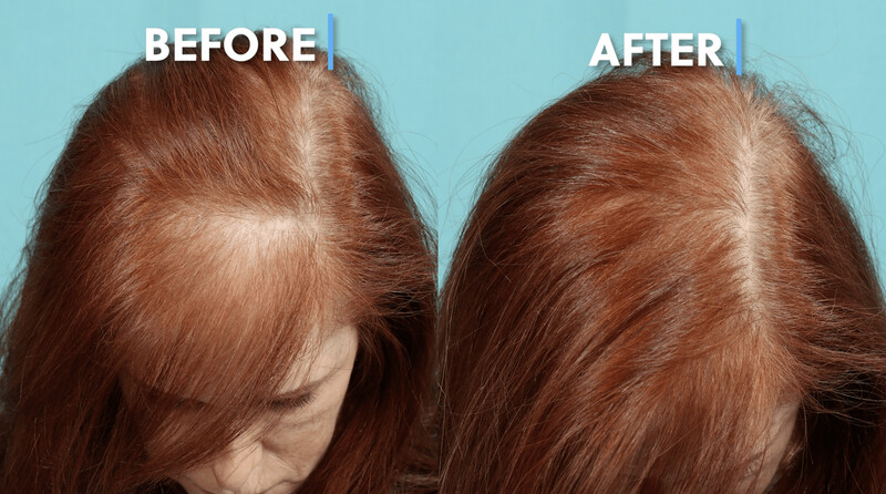 Hair Restoration Package of 3 Hair Restoration Package of 3