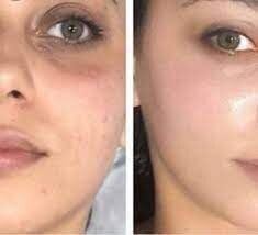 BB Glow Eye Treatment