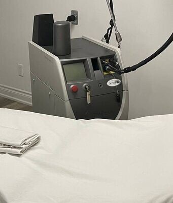 Candela Full Body Laser