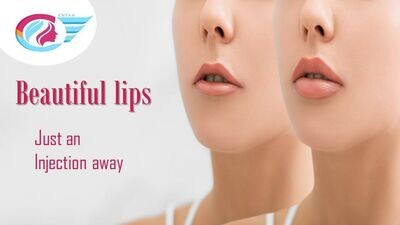 Tenting Lip Filler(Custom) Tenting Lip Filler(Custom)