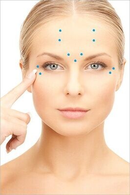 50 Units Botox