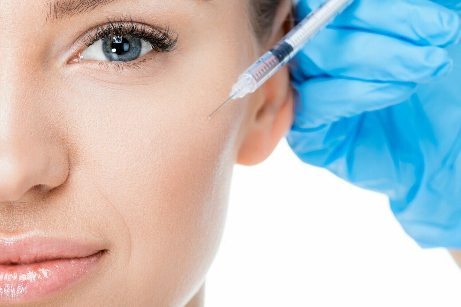 3 ML Filler Special  (Couples, Family and Friends)