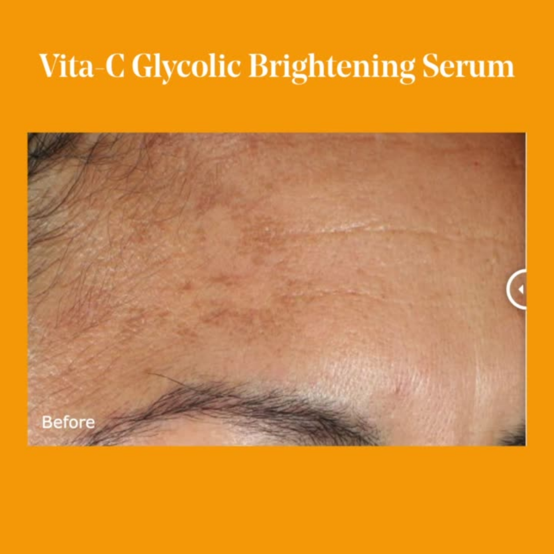 Murad Vita-C Glycolic Brightening Serum 30ml