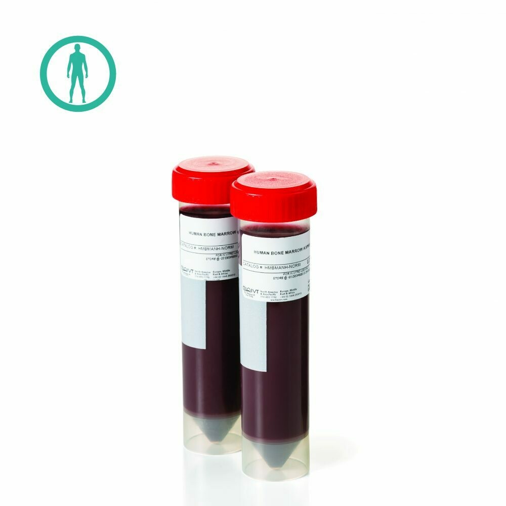 Bone Marrow Aspirate