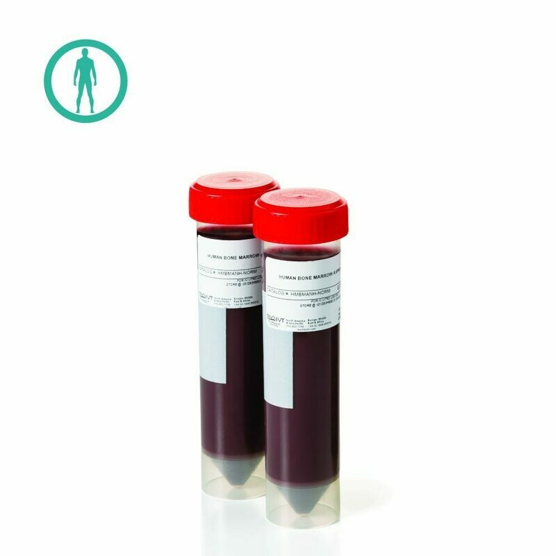 Bone Marrow Aspirate