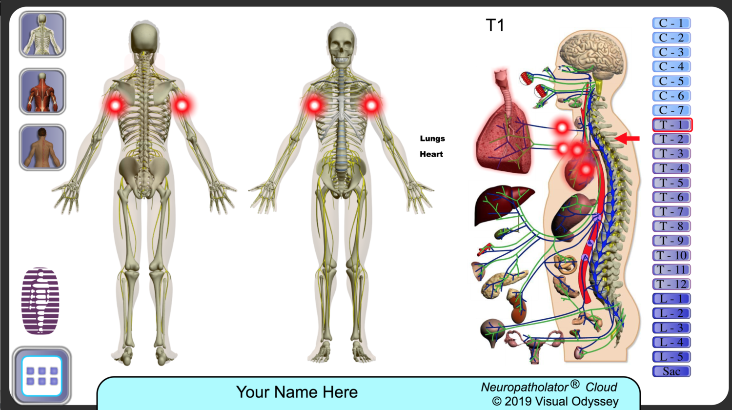 NP-3-Neuropatholator Starter + ROF (for PC or Mac) and Phone App for $49 per month