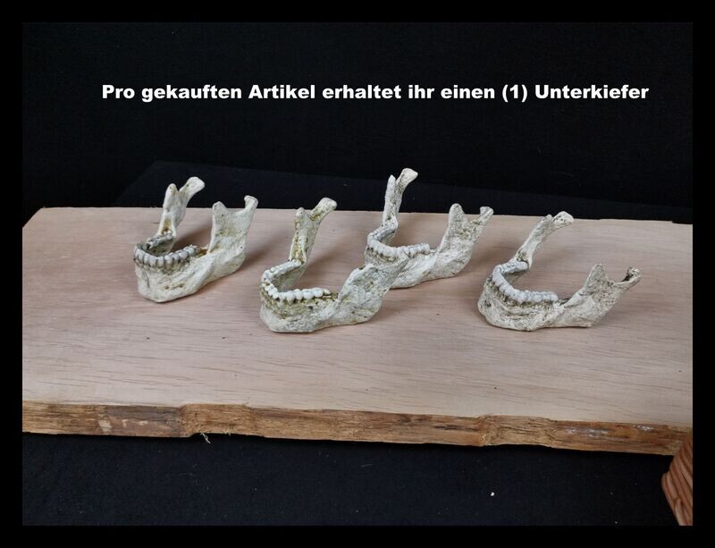 Unterkiefer (Mensch)