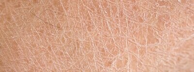 Natural Skincare for Dry Skin