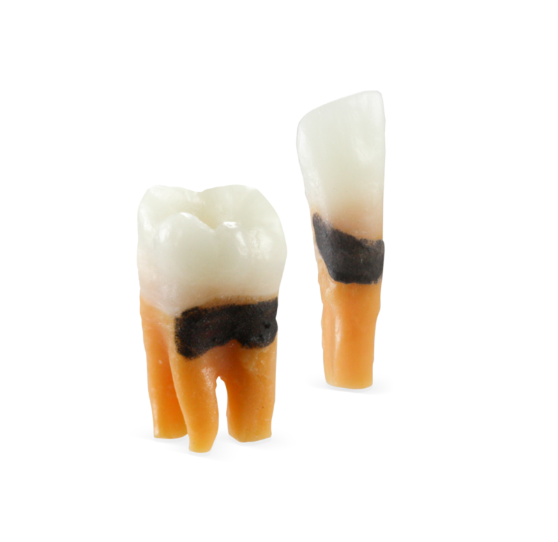 ModuPRO Perio Replacement Teeth