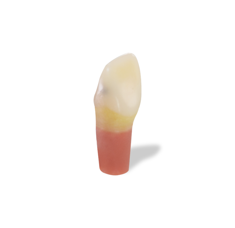 RTX Caries Teeth Distal #09