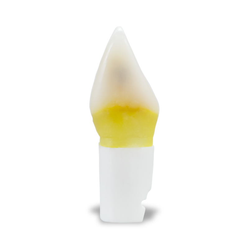 DTX Carious Tooth #09