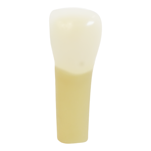PCT Caries, Mesial Lingual (Class III) #08
