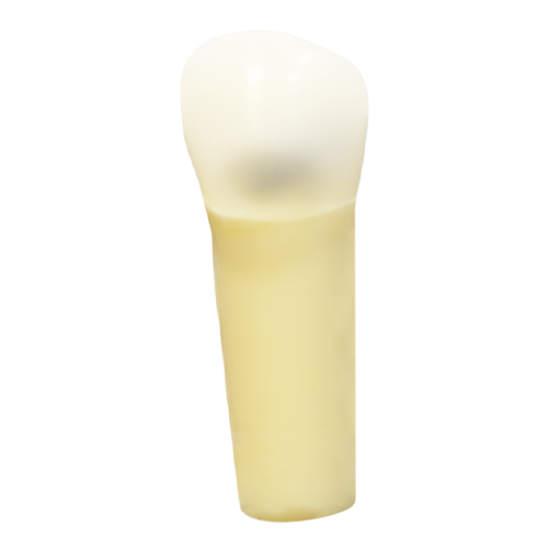 PCT Caries, Facial Distal (Class V) #20