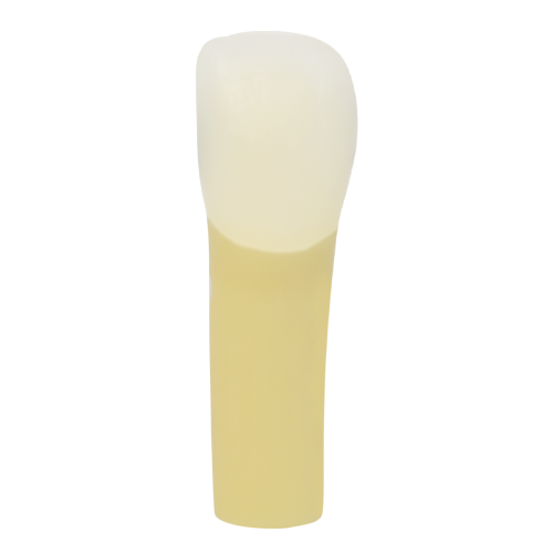 PCT Caries, Mesial Distal (Class III) #07