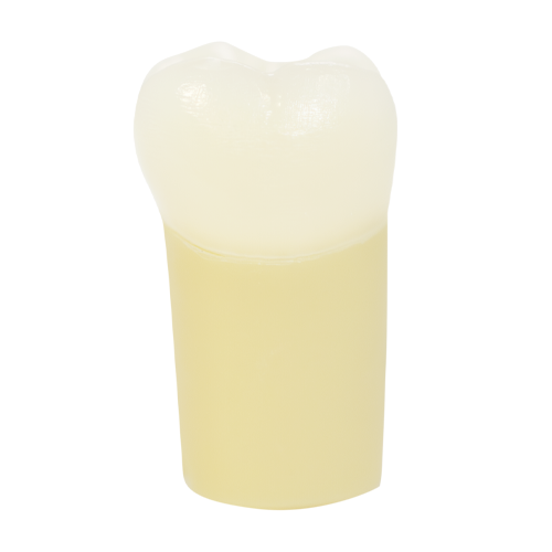 PCT Caries, Occlusal (Class I) #18