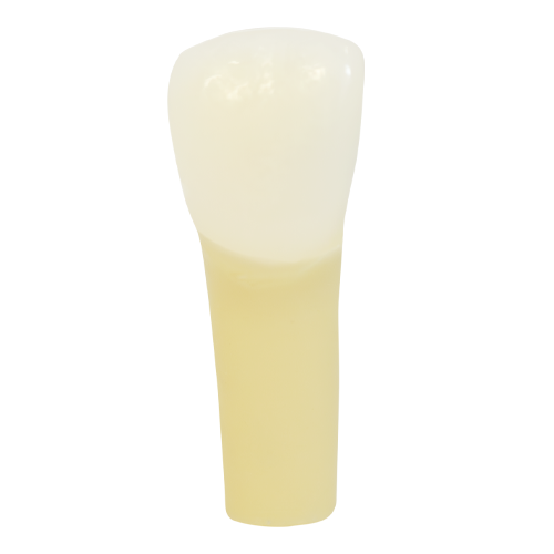 PCT Caries, Mesial (Class III) #9