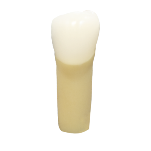 PCT Caries, Distal Occlusal (Class II) #29