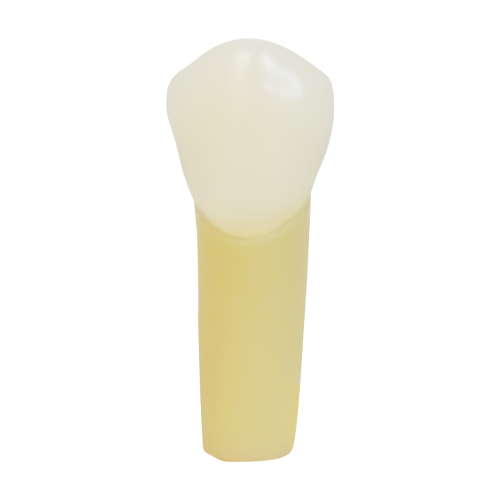 PCT Caries, Mesial Occlusal Distal (Class II) #5