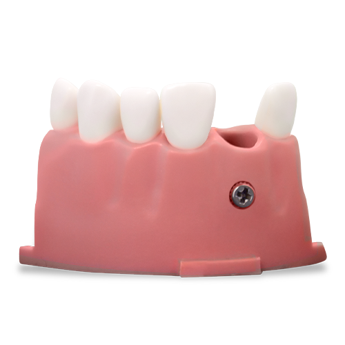 RT OS3 (Endo/Pros) Upper Anterior Mod 07-12 w/M300 Teeth