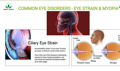 Products for eye strain