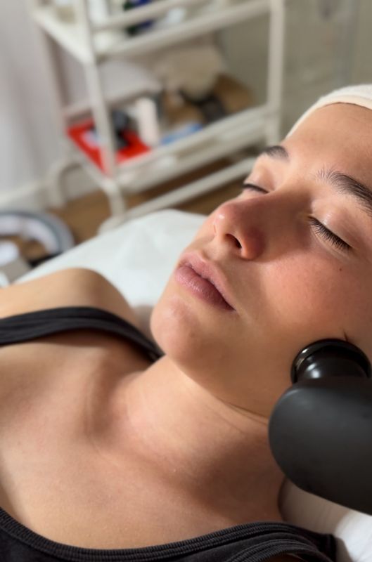 Tractament LIFTING amb radiofreqüència facial per recuperar fermesa i elasticitat a la pell