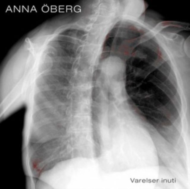 Anna Oberg