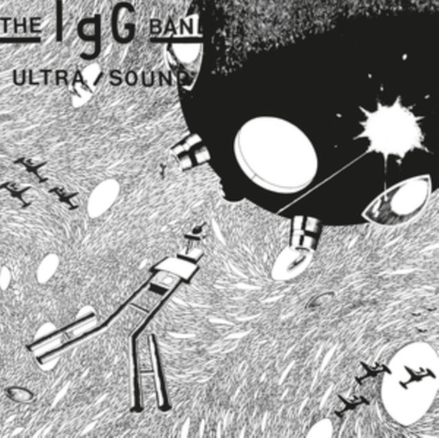 Igg Band