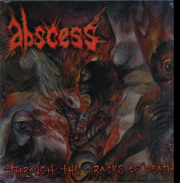 Abscess