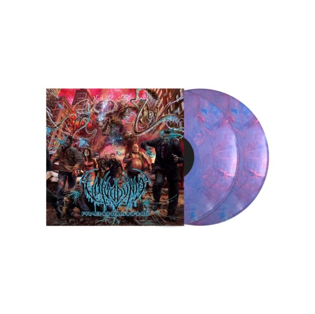 Vulvodynia