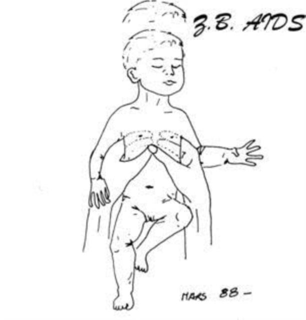 Z.B. Aids