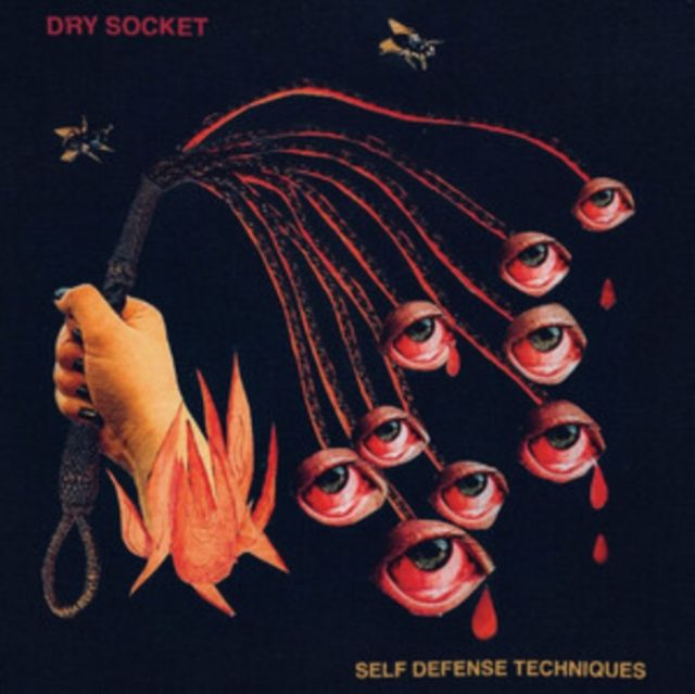 Dry Socket