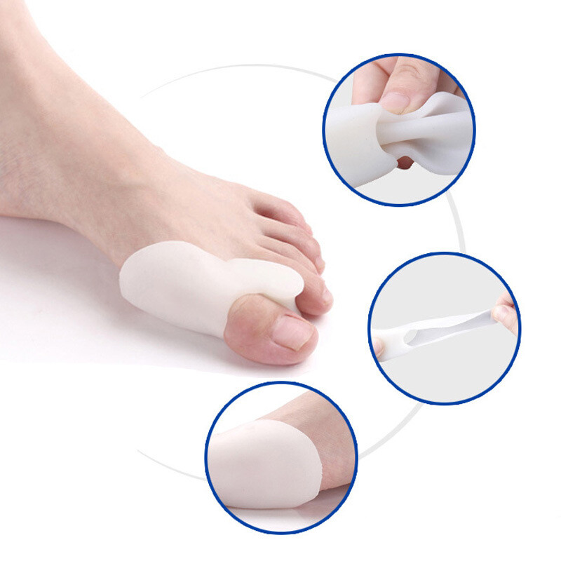 Corretores de Joanetes em Silicone