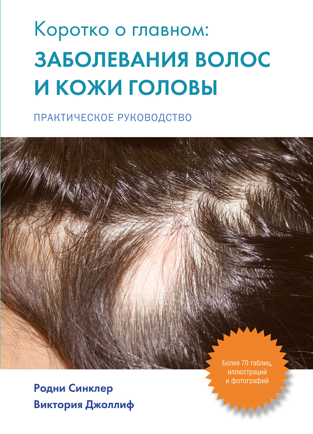 Заболевания волос и кожи головы