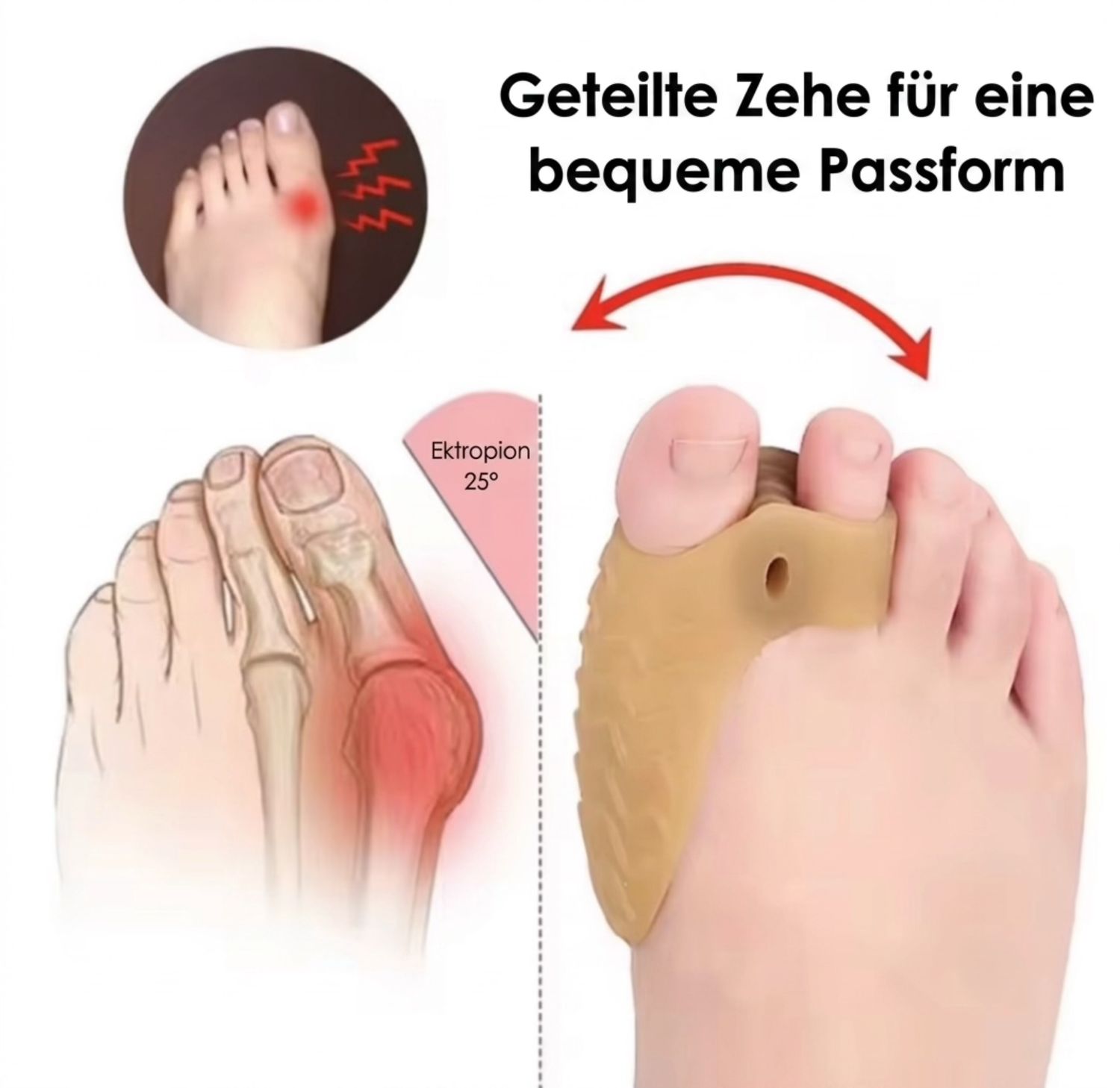 Hallux-Schutz-Pad | Gel-Korrektur für Großzehen Dancecode