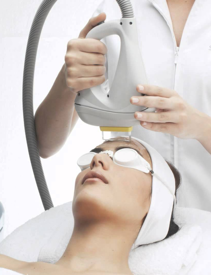 Fotorejuvenecimiento facial