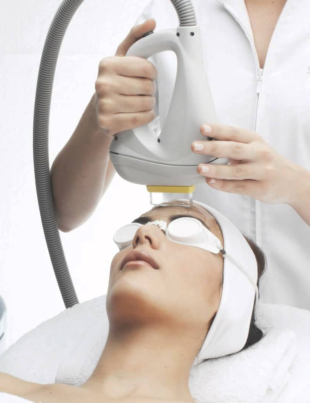 Fotorejuvenecimiento facial