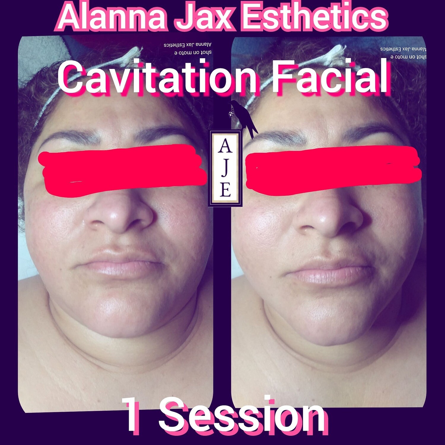 4 Cavitation Facials w/Skin Tightening & the WORKS
