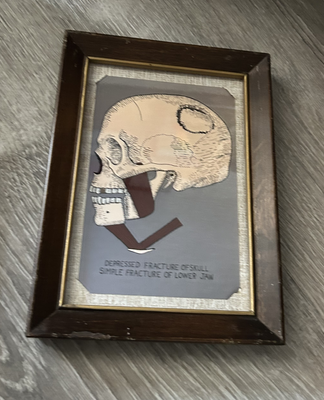 Martin Munroe - Head (small)