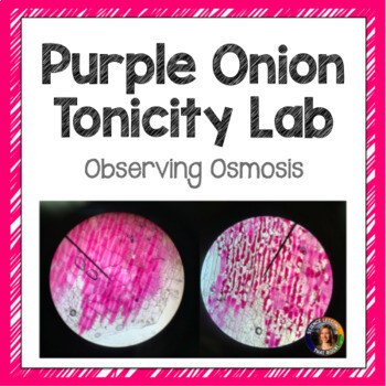 Cell Membrane Osmosis Tonicity Lab