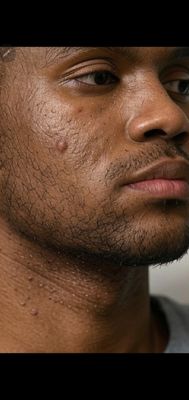 Pigmentation Repair — Black &amp; Dark Skin