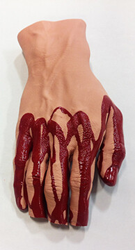 Hand with Severed Fingers by Simulaids®