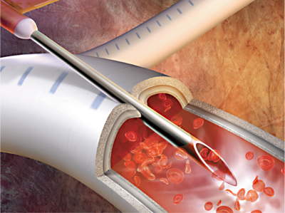 ADVANCED PHLEBOTOMY & CANNULATION COURSE (GPT004E) ADVANCED PHLEBOTOMY & CANNULATION COURSE (GPT004E)