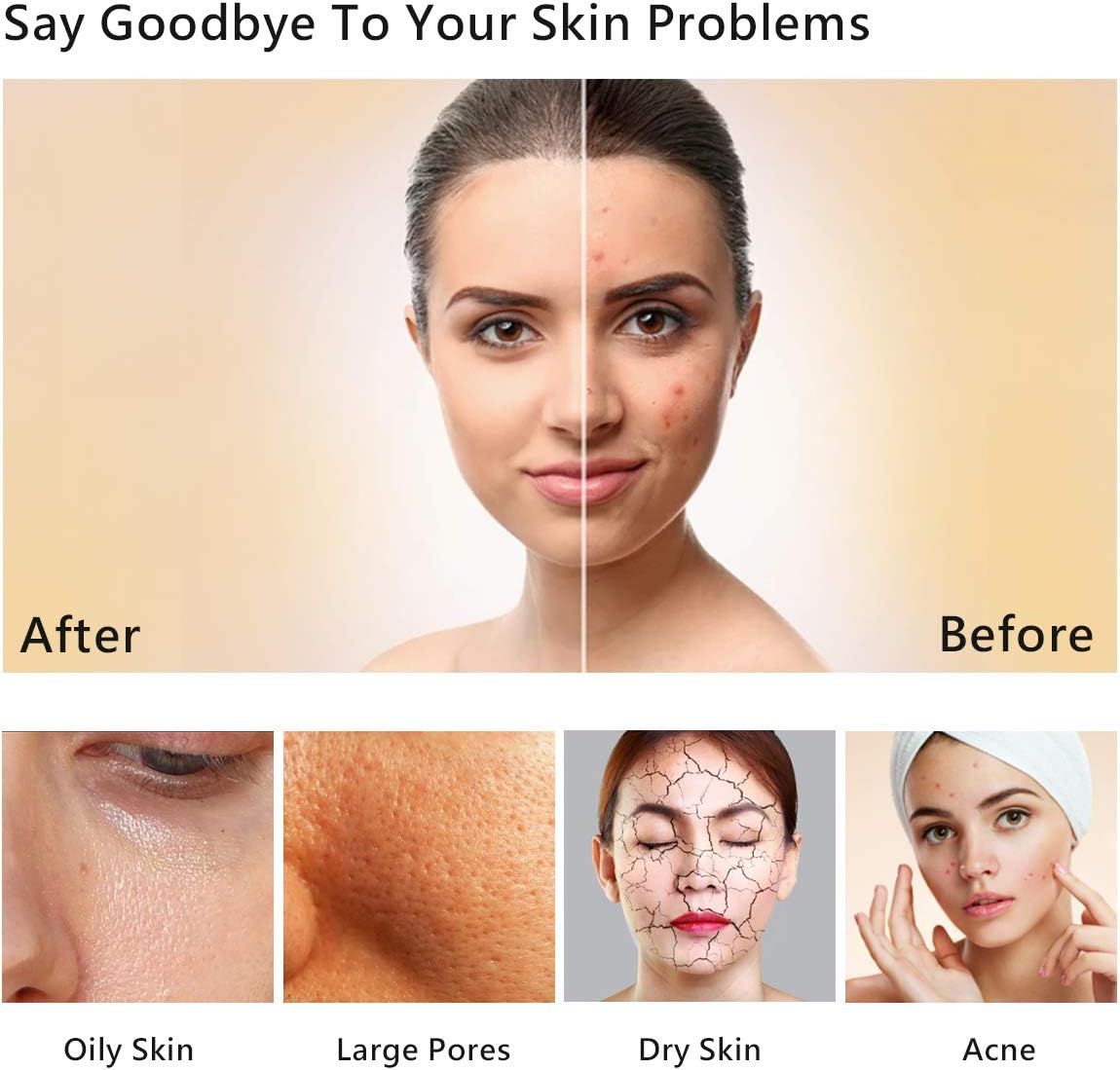 Facial Steamer Nano Ionic Face Sauna Hot Mist