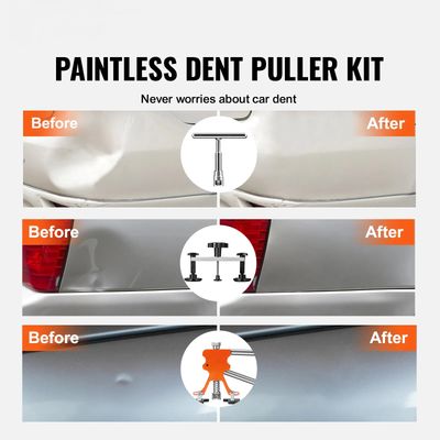 Paintless Dent Repair Kit – 57-Piece Car Dent Removal Tool Set with Glue Gun