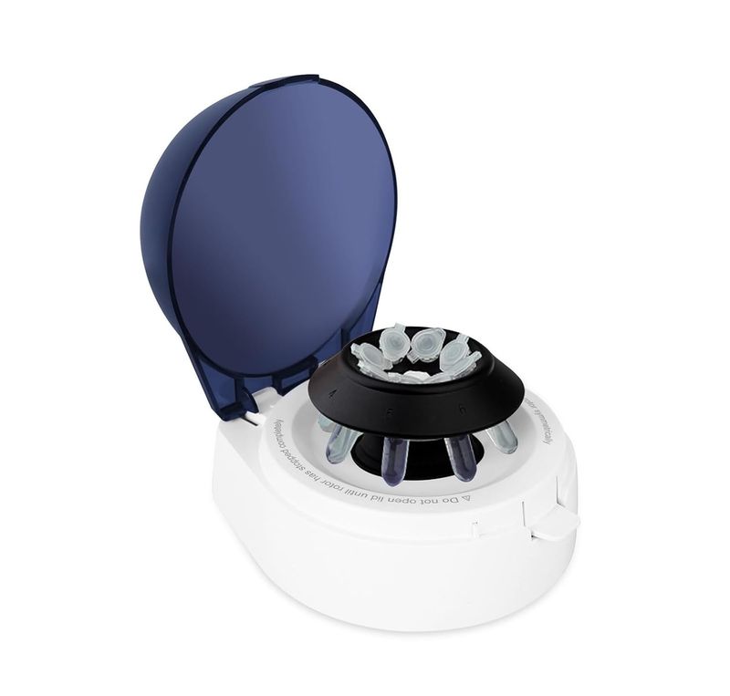Mini Electric Centrifuge Machine 7000RPM Blood Centrifuge Tester with Fixed Speed Rotor Laboratory Microfiltration Device