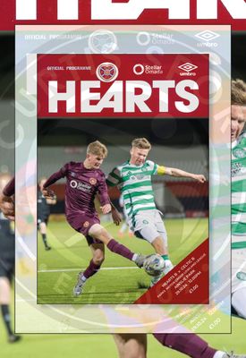 Hearts B v Celtic B - 29/10/24